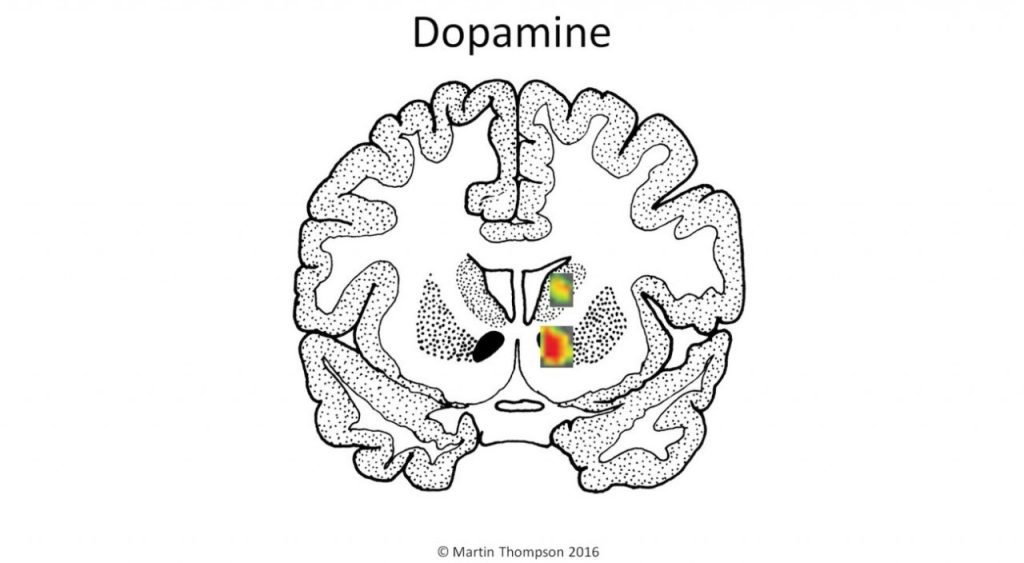 Dopamine with music
